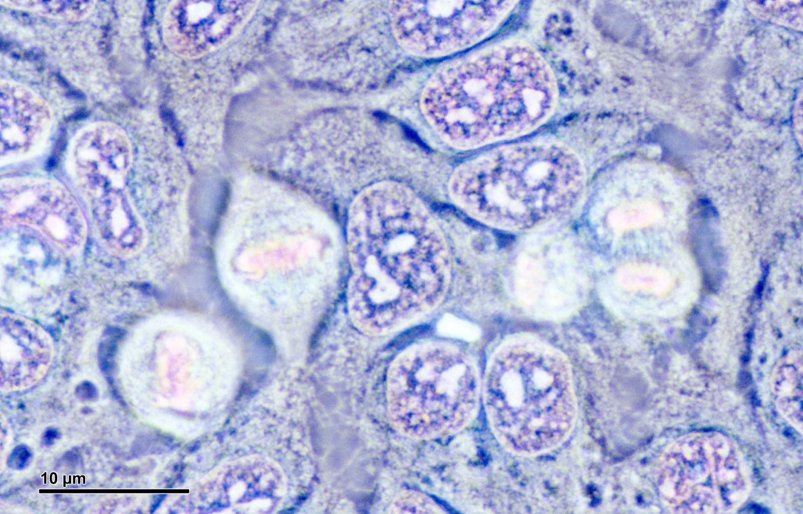 A microscopy image of cultured HeLa cells, several of them caught mid-division, their chromosomes visible in the stages of mitosis against a stained background.