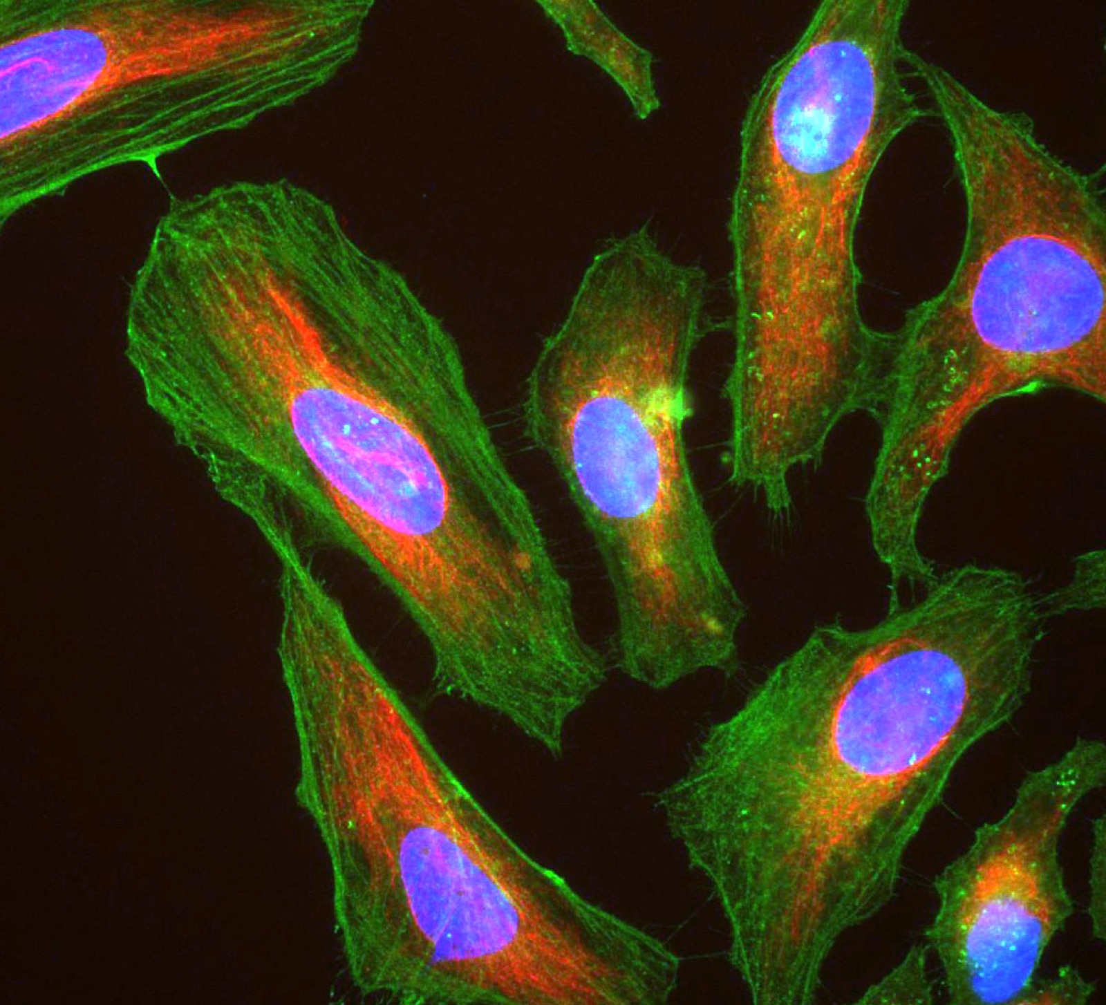 A fluorescence microscopy image of HeLa cells against a black background: several cells glowing green (the protein actin) and red (vimentin), each with a large blue-violet nucleus.