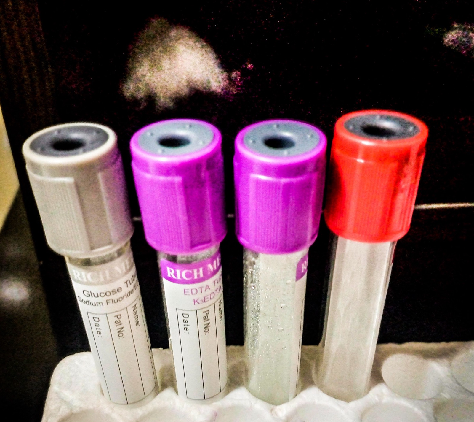 A close view of laboratory test tubes held in a rack, the slim glass tubes containing small amounts of liquid, in a clinical setting.