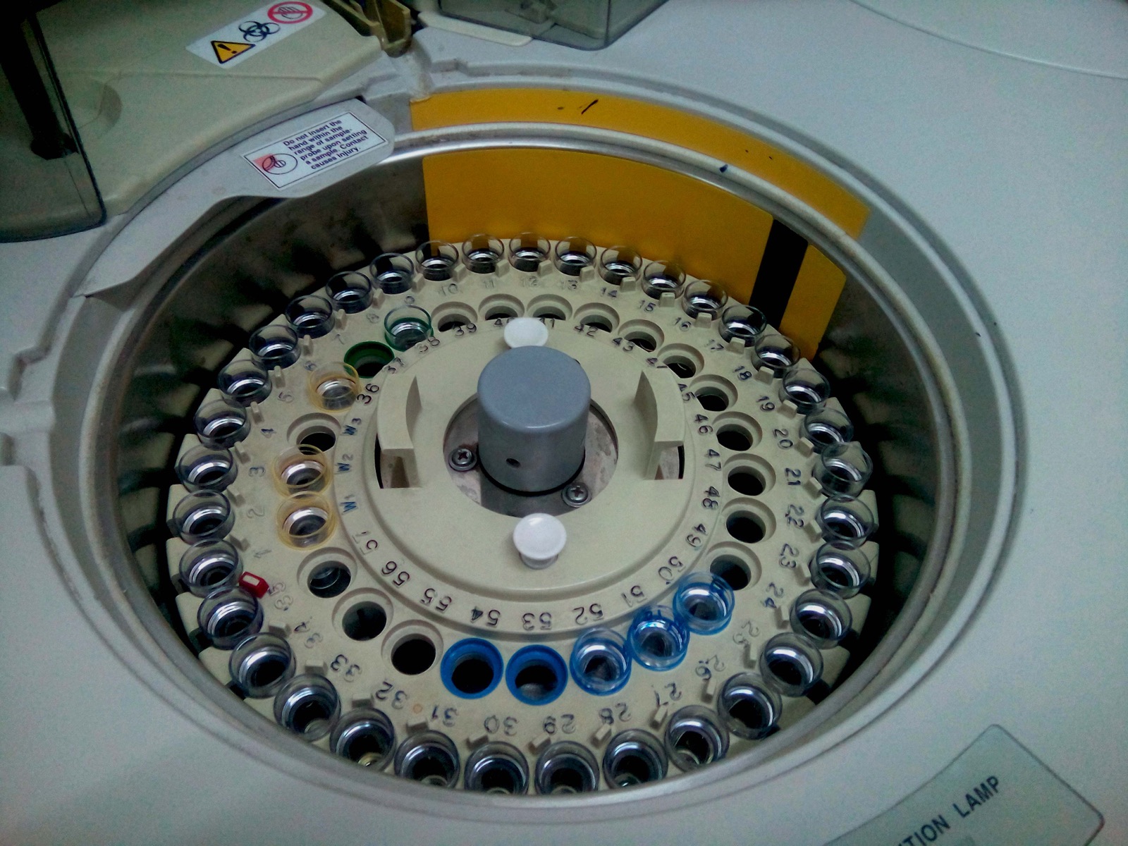 A large clinical chemistry analyzer machine in a medical laboratory, a boxy automated instrument with sample racks and a screen.