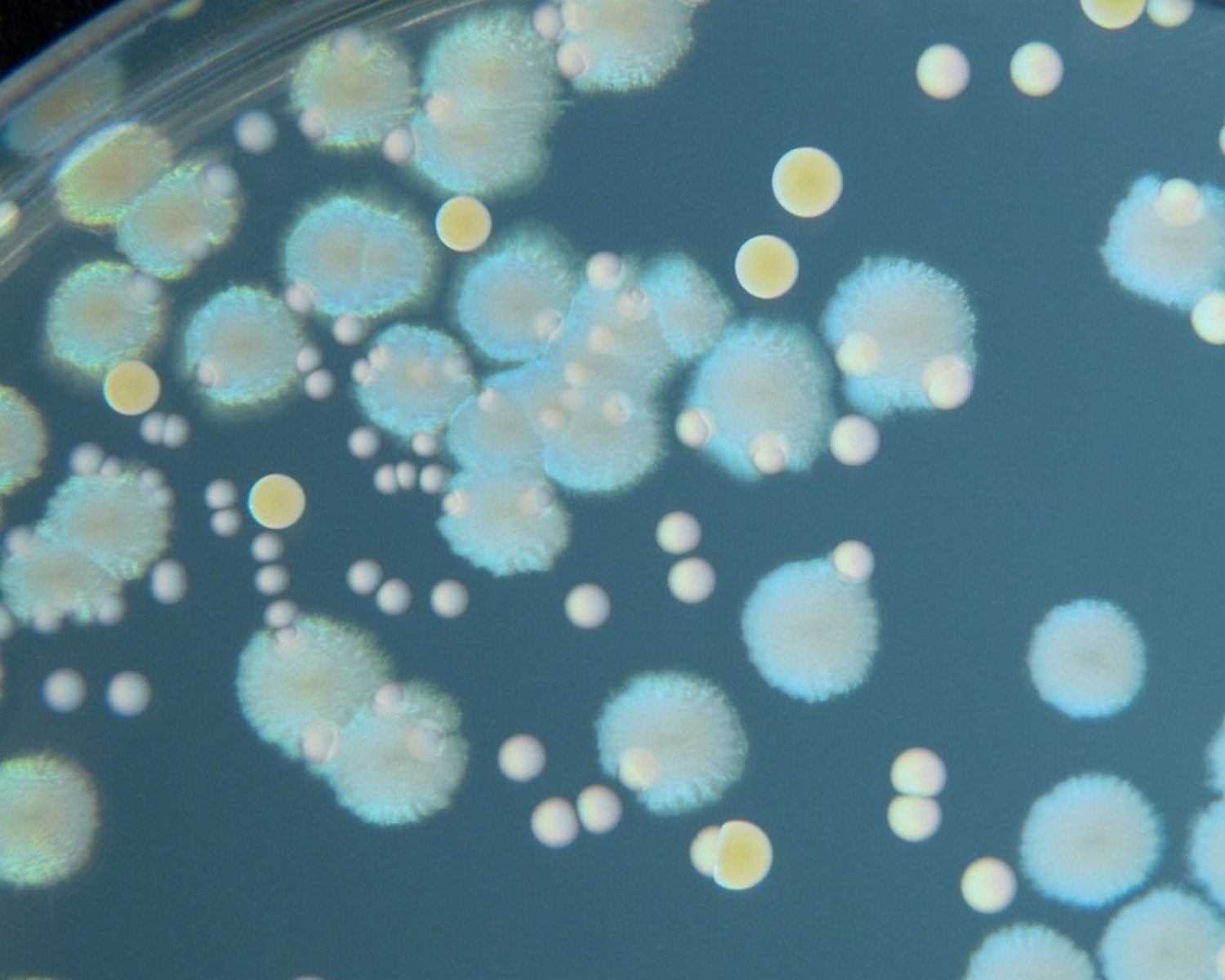 Bacterial colonies growing on an agar plate in a laboratory, showing the kind of microbial culture central to microbiome science.